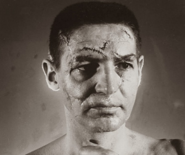 4. Terry Sawchuk, 1966, Buz hokeyİ oyuncusunun yüzünün fotoğrafı.
