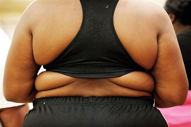 Obezitede seks steroidlerinin bağlanması